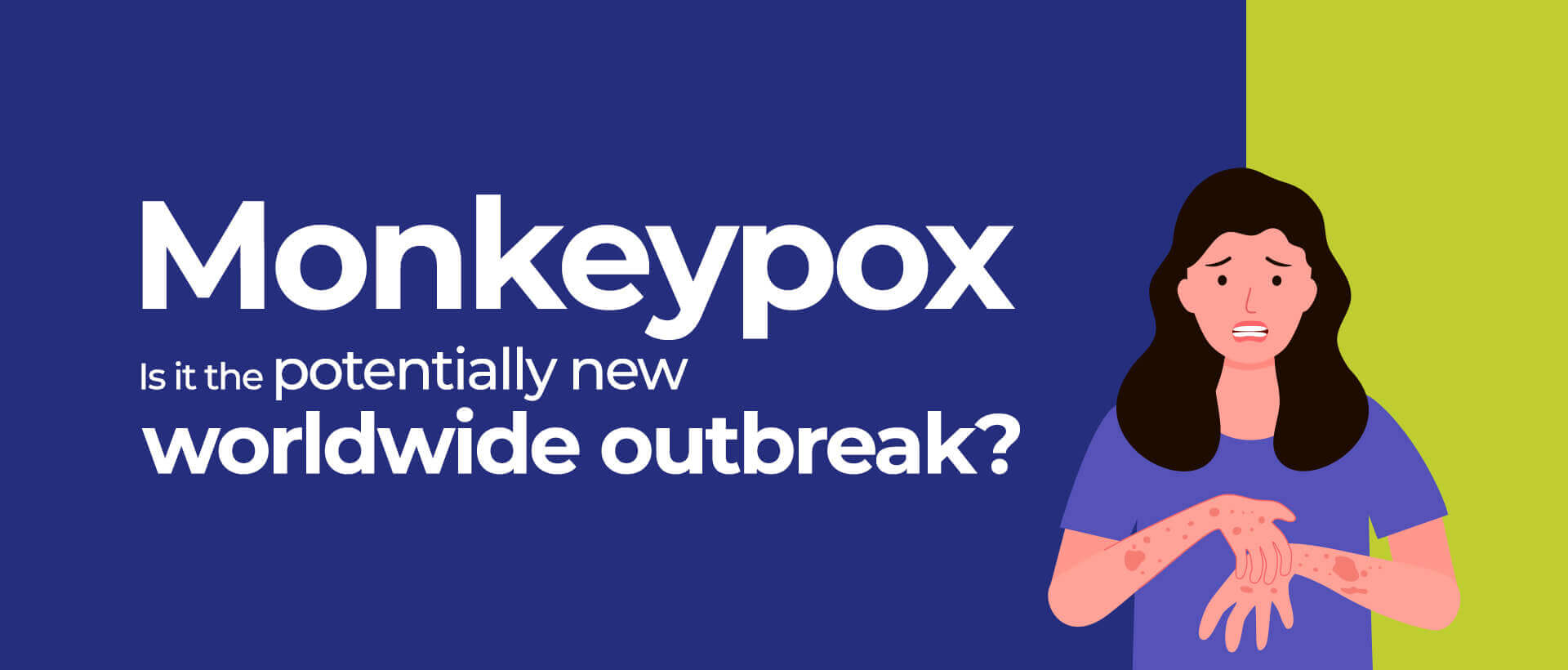 Monkeypox: Is it the potentially new worldwide outbreak?